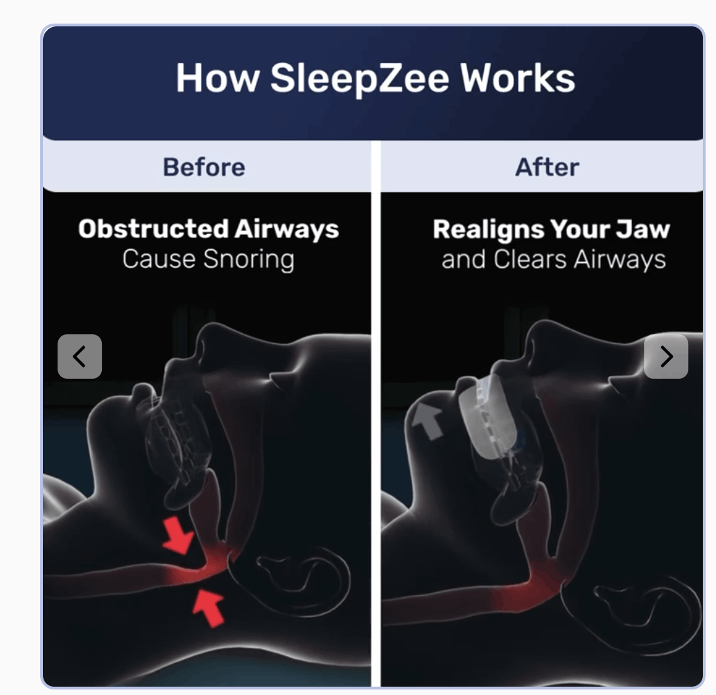 How sleepzee works